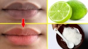 How to get pink lips naturally in nigeria
